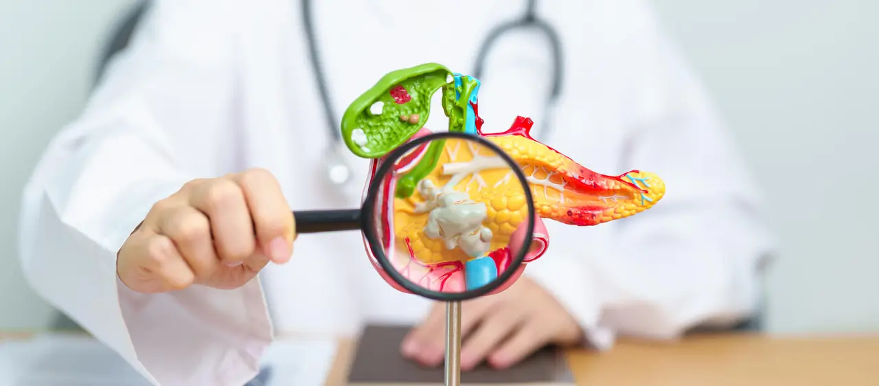 Doctor with human Pancreatitis anatomy model with Pancreas, Gallbladder, Bile Duct, Duodenum, Small intestine and magnifying glass. Pancreatic cancer, acute pancreatitis and Digestive system