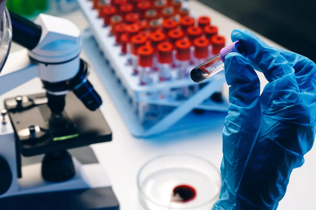 Hands of a laboratory worker doing blood test, close up