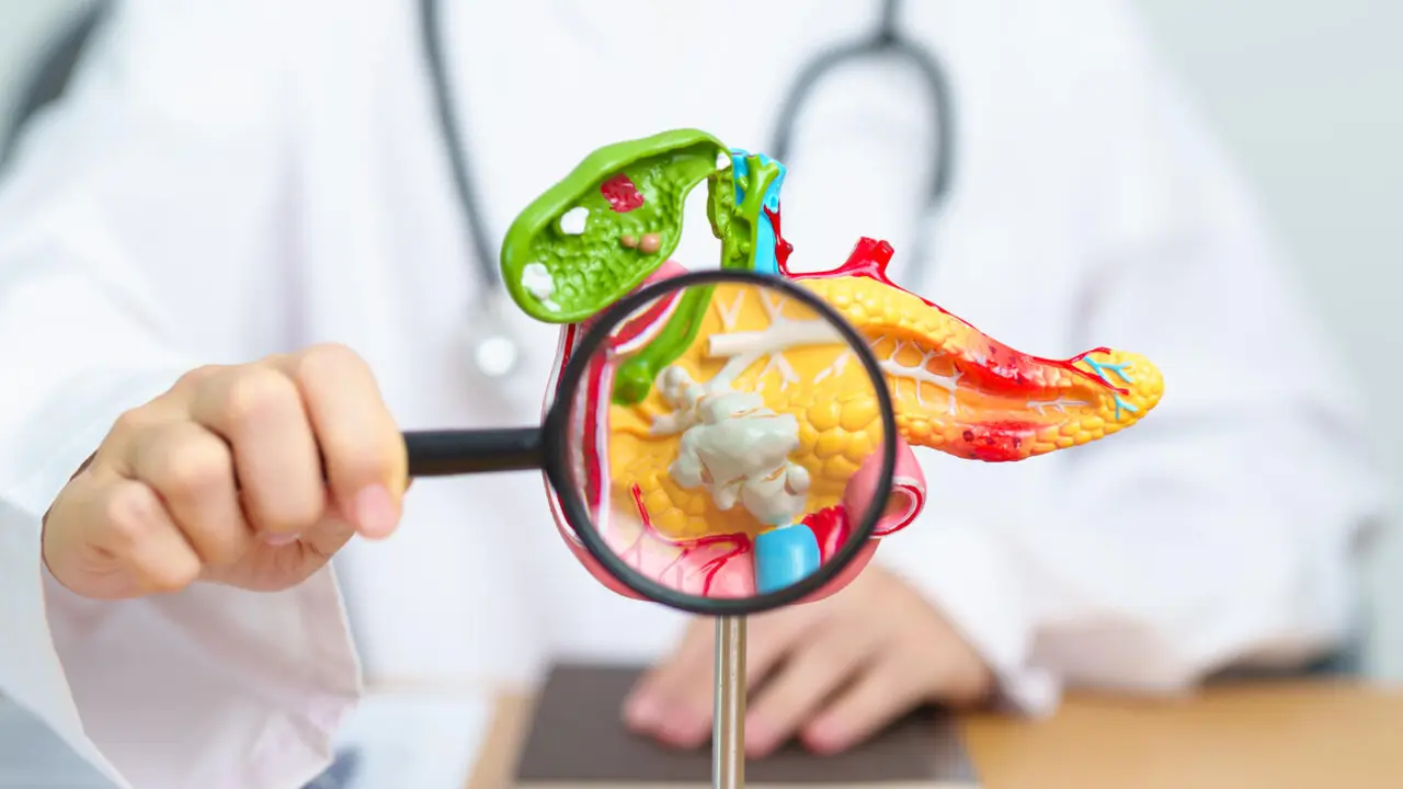 Doctor with human Pancreatitis anatomy model with Pancreas, Gallbladder, Bile Duct, Duodenum, Small intestine and magnifying glass. Pancreatic cancer, acute pancreatitis and Digestive system